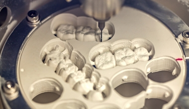 Worum handelt es sich bei der CAD/CAM-Technologie, und weshalb ist diese Behandlungsmethode dermaßen neuartig?